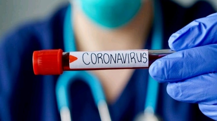 CoronaVirus: Ghana Records 4 Deaths, 137 Cases, 2 Recovered And Discharged