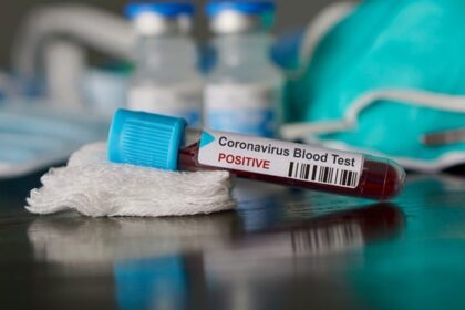Ghana Records 408 Coronavirus cases