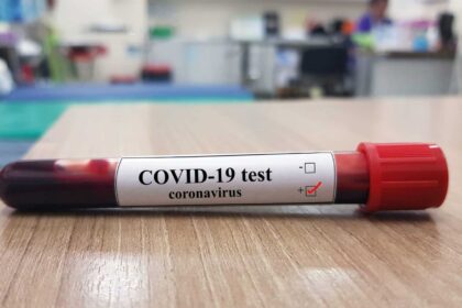 CoronaVirus: Ghana's active Covid-19 cases hit 1,156