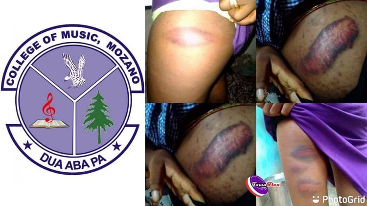 Agona Swedru: Teachers Inflict Wounds On SHS Students For Failing To Attend Prep
