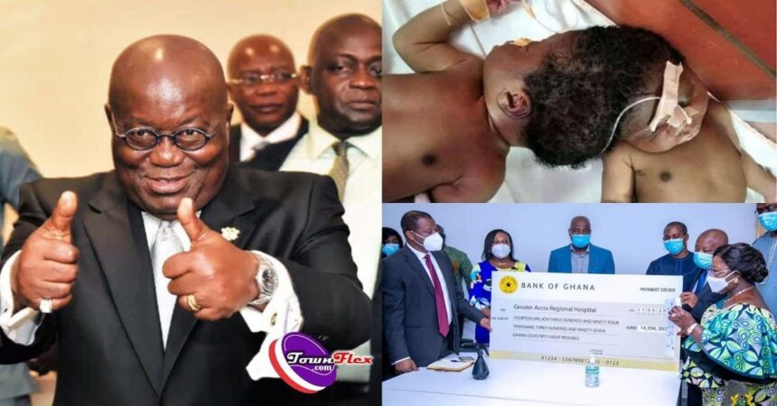 Conjoined Twins: Akufo-Addo Pays Full Cost For Surgery (Photos)