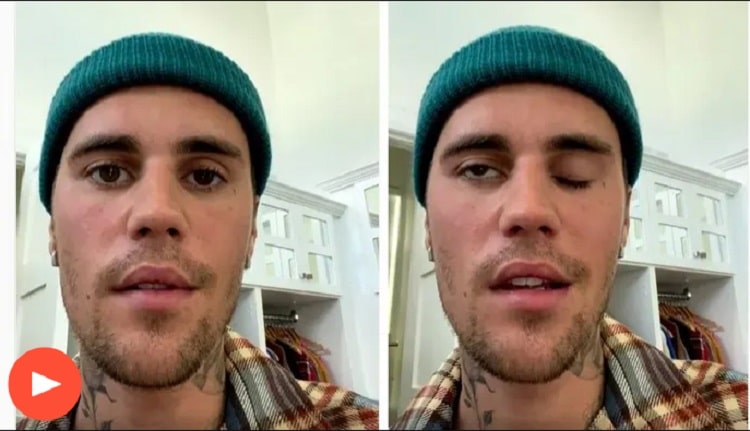 Justin Bieber announces he has facial paralysis due to Ramsay Hunt syndrome [Video]