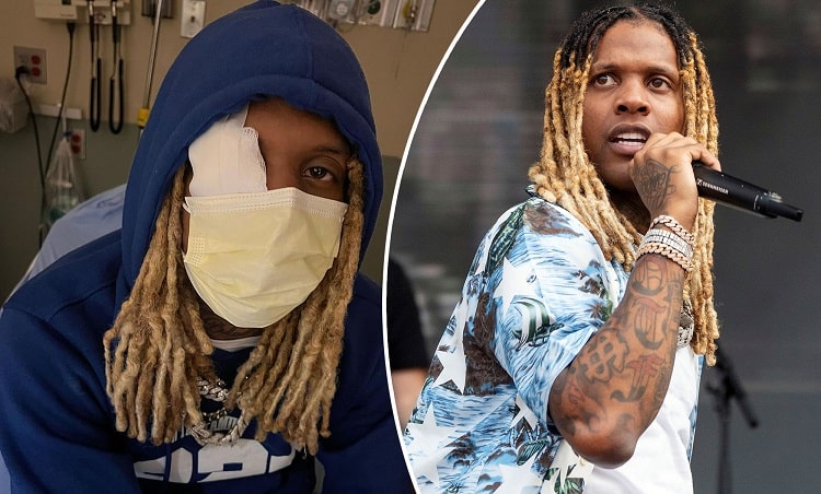 Rapper Lil Durk to ‘Take a Break’ After Getting Hit With Pyrotechnic at Lollapalooza 2022