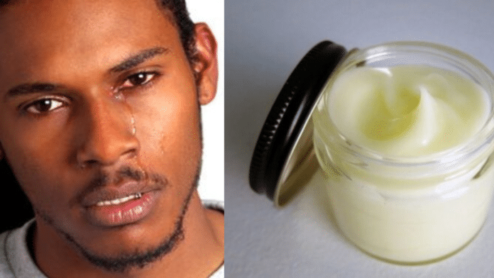 CAUTION! Man ends up with bleached manhood after using enlargement cream he bought online