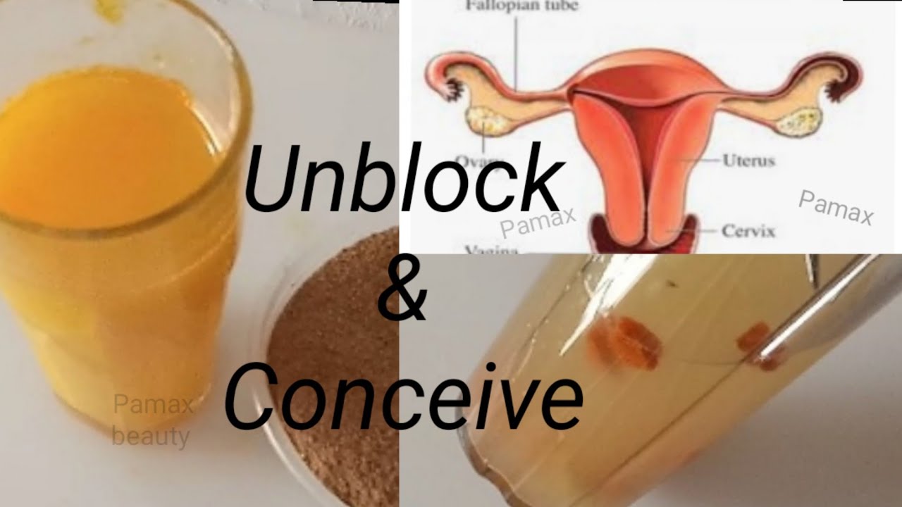 Get Pregnant Naturally: The Surprising Ways to Unblock Your Fallopian Tubes and Boost Fertility