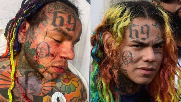 Tekashi 6ix9ine’s 911 call released after gym attack