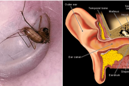 bug stuck inside your ear dont panic follow these steps world of buzz