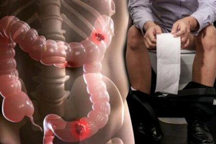 Boost Your Bowel Function: 7 Foods to Avoid and 8 to Embrace!