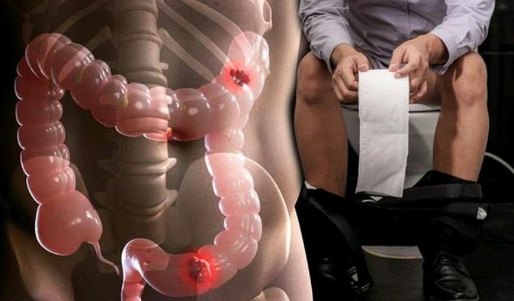 Boost Your Bowel Function: 7 Foods to Avoid and 8 to Embrace!