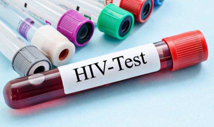 Bono Region Records 884 New HIV Infections