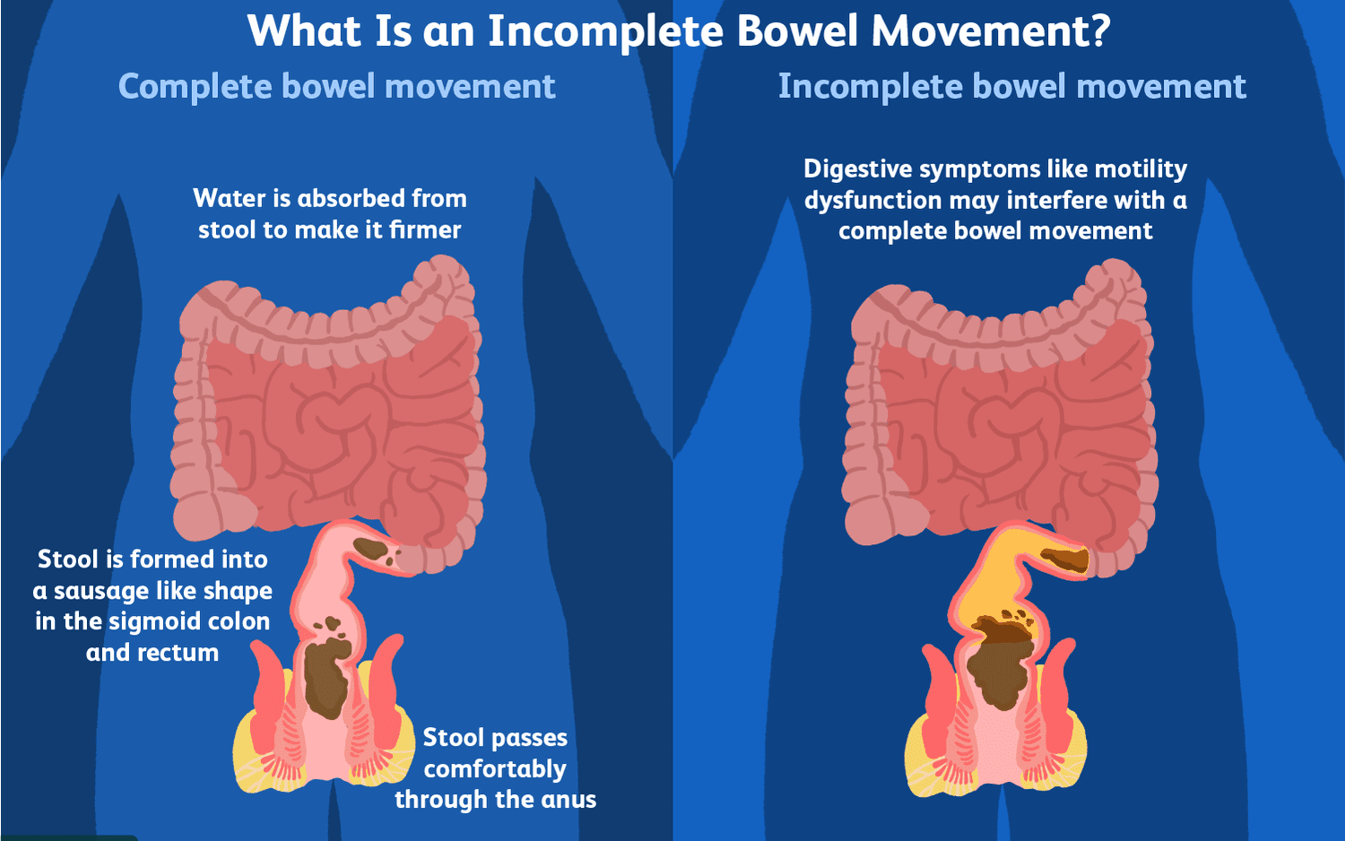 Boost Your Bowel Health: 15 Foods That Can Make a Difference