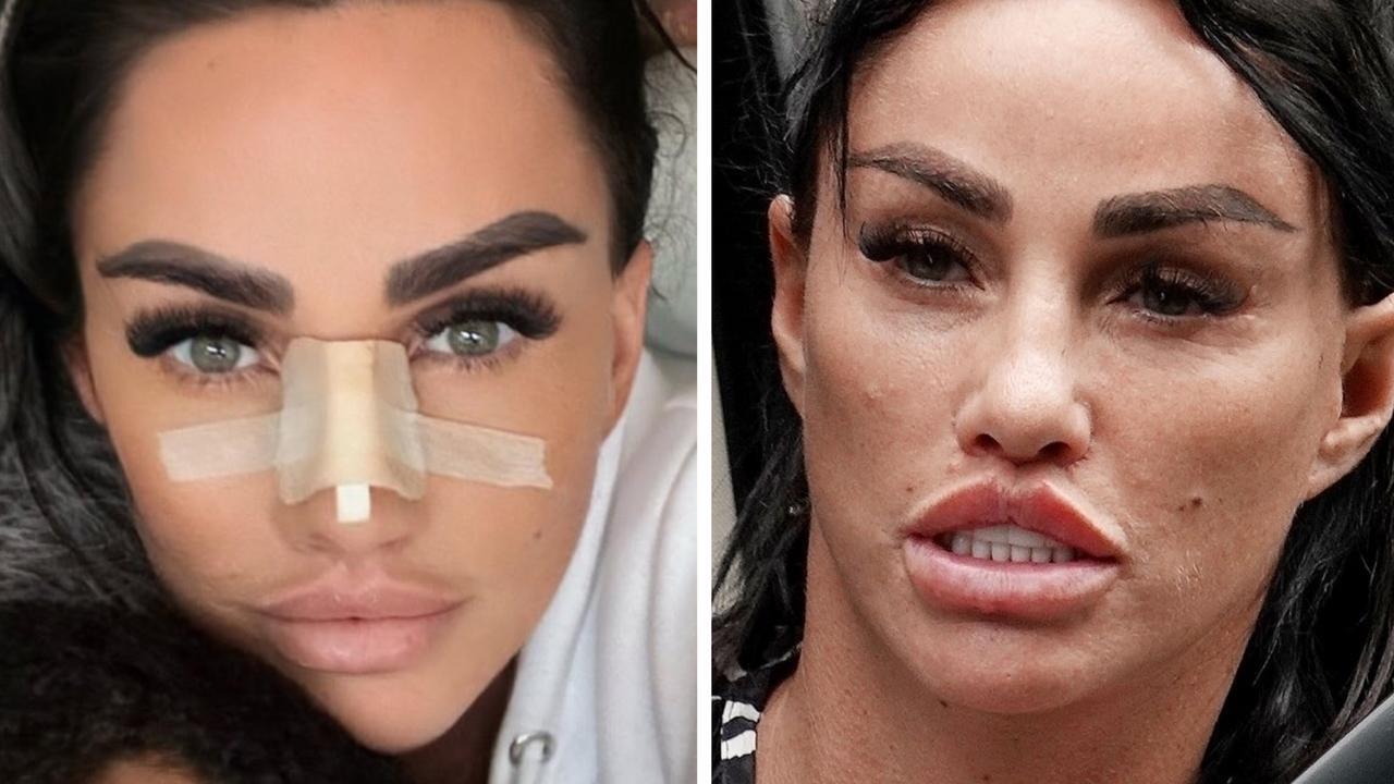 Passport Machines Can't Recognize Katie Price's Face After 6th Facelift (+PHOTOS)