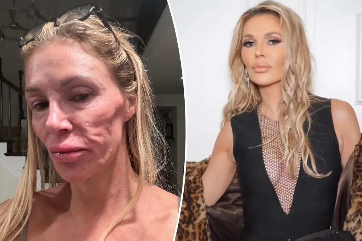 Brandi Glanville’s Shocking Selfie: TV Star Opens Up About Parasite Health Scare 2 Brandi Glanville’s Shocking Selfie: TV Star Opens Up About Parasite Health Scare