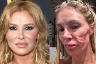 Brandi Glanville’s Shocking Selfie: TV Star Opens Up About Parasite Health Scare