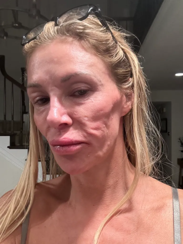 Brandi Glanville’s Shocking Selfie: TV Star Opens Up About Parasite Health Scare 3 Brandi Glanville’s Shocking Selfie: TV Star Opens Up About Parasite Health Scare
