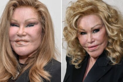 Jocelyn Wildenstein, ‘Catwoman’ Socialite and Plastic Surgery Icon, Dies at 84