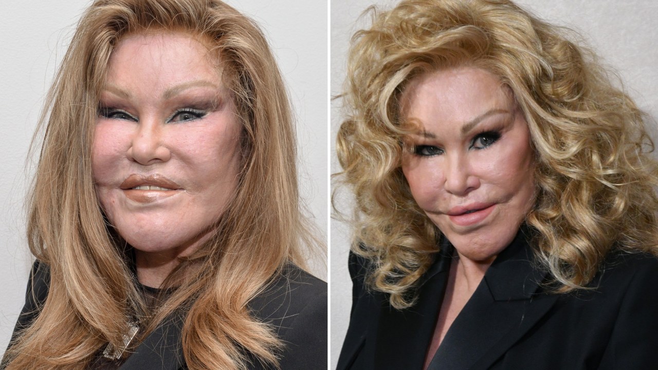 Jocelyn Wildenstein, ‘Catwoman’ Socialite and Plastic Surgery Icon, Dies at 84