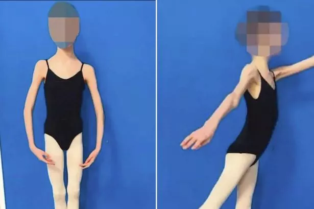 Teen ballerina who shrunk to 4st begs judge to overturn parents' jail term