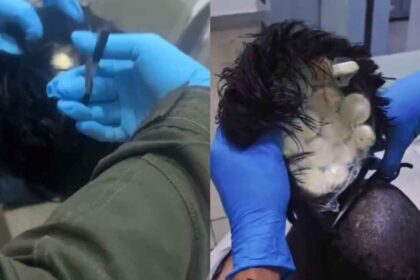 Man Arrested for Attempting to Smuggle Cocaine Worth $10,000 Under His Wig