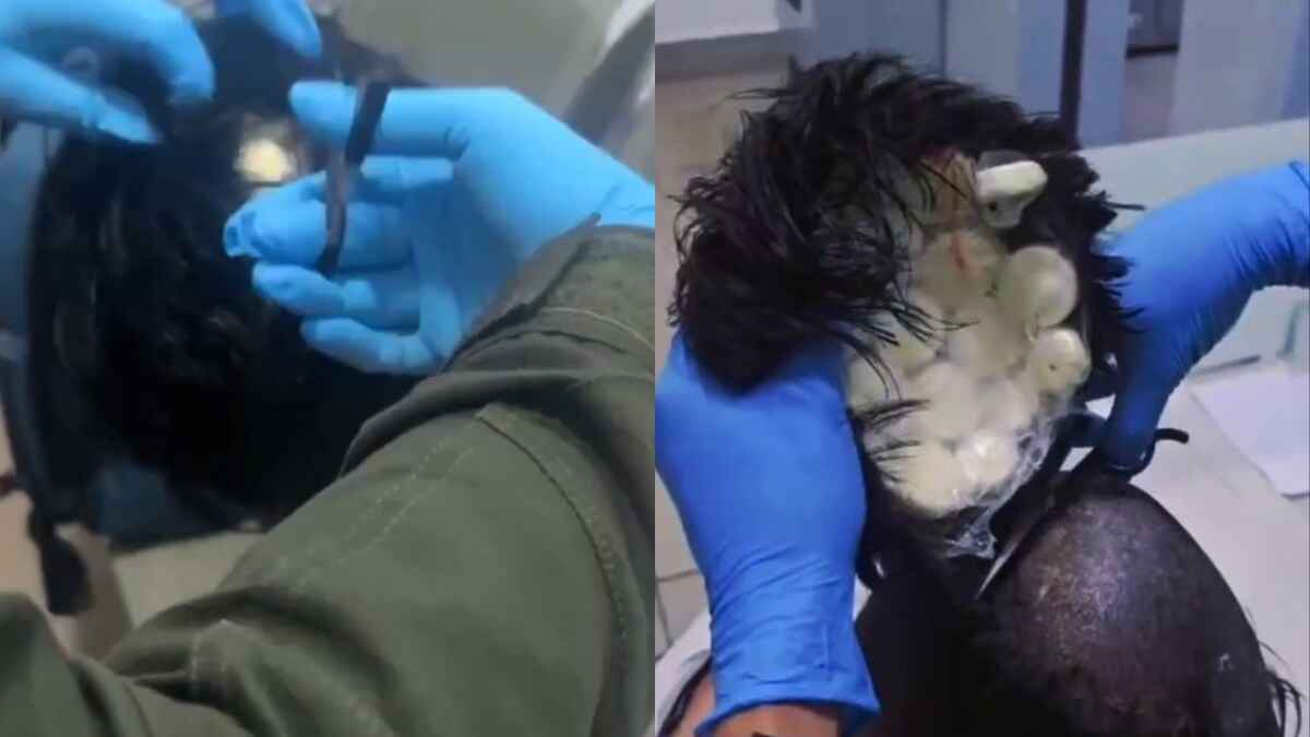 Man Arrested for Attempting to Smuggle Cocaine Worth $10,000 Under His Wig