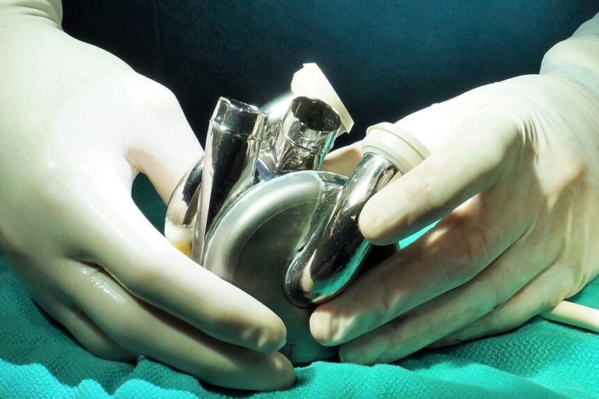 Australian man survives for 105 days with titanium heart 1 Australian man survives for 105 days with titanium heart