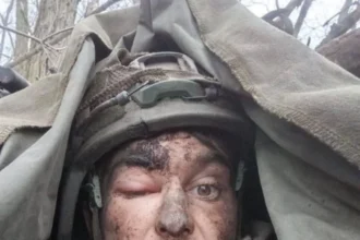 Russian Soldier Allegedly Fights for a Week with Bullet Stuck in His Brain