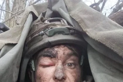 Russian Soldier Allegedly Fights for a Week with Bullet Stuck in His Brain