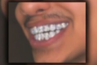 Florida Man Sentenced for $4 Million COVID-19 Fraud Scheme, Spending On Diamond Grills
