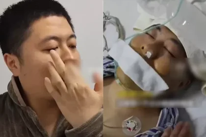 Man Undergoes Emergency Surgery After Suffering Ruptured Artery by Picking His Nose