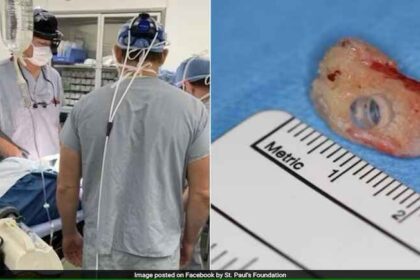 Canadian Doctors Implant Tooth in Blind Woman’s Eye to Restore Vision Tooth-in-eye surgery