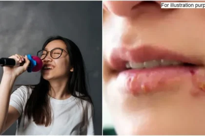 Woman Catches Herpes After Holding Karaoke Mic Too Close to Her Mouth