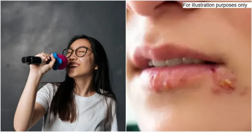 Woman Catches Herpes After Holding Karaoke Mic Too Close to Her Mouth 1 Woman Catches Herpes After Holding Karaoke Mic Too Close to Her Mouth